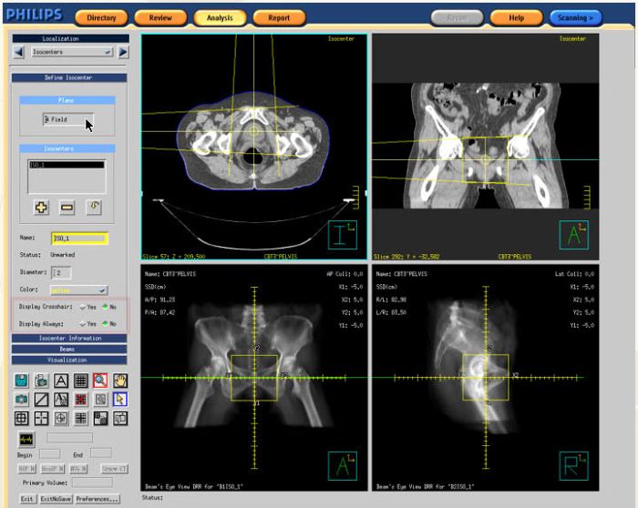 Philips Spectral CT 7500