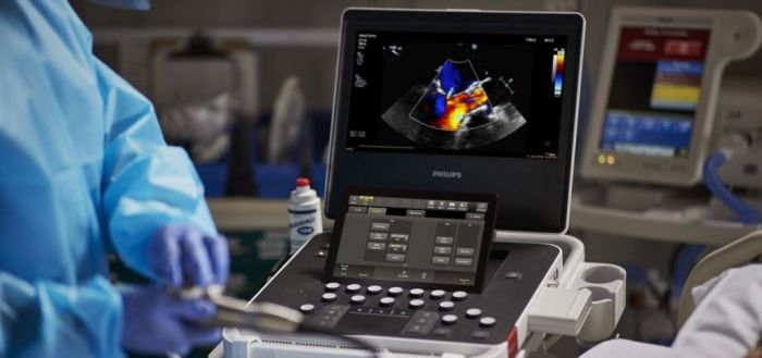 Philips Compact Ultrasound System 5500CV