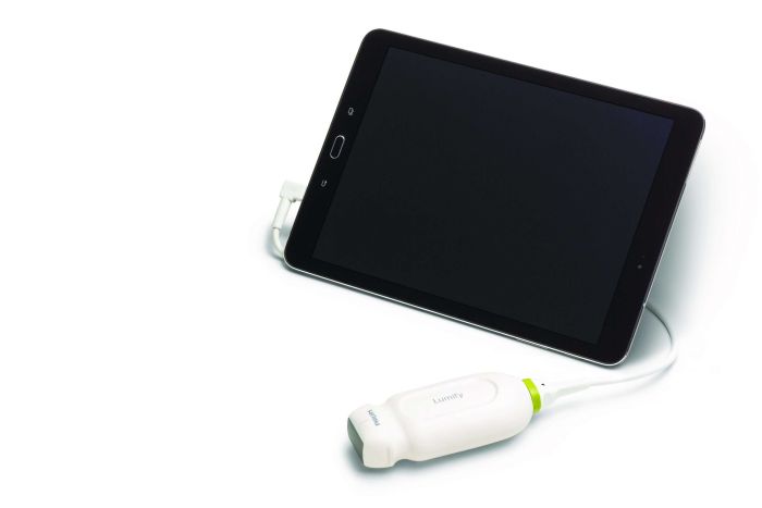 Philips Lumify